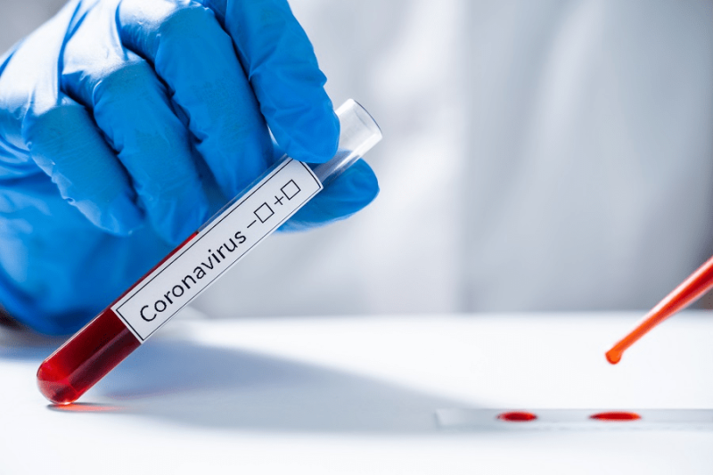 Negligencias Médicas relacionadas con el Coronavirus