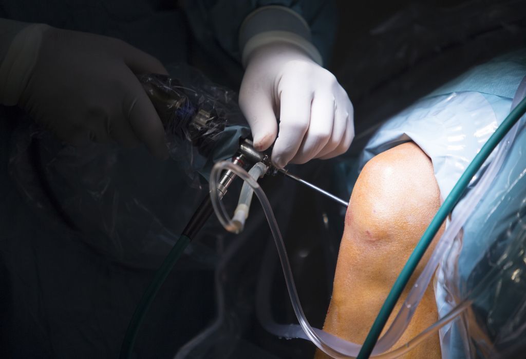 una mano de cirujano con guante blanco está operando una rodilla